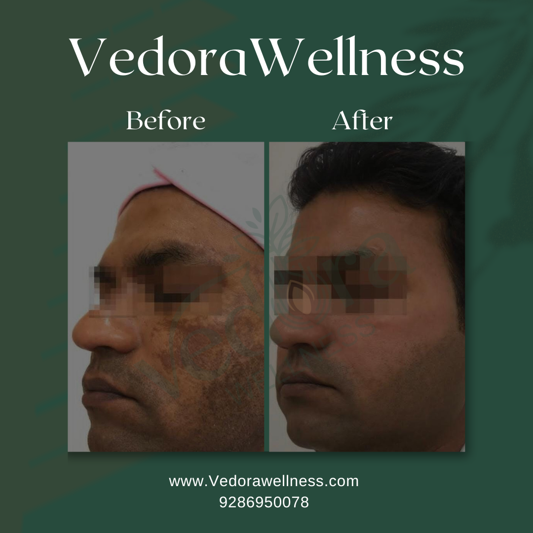 vendor wellness media