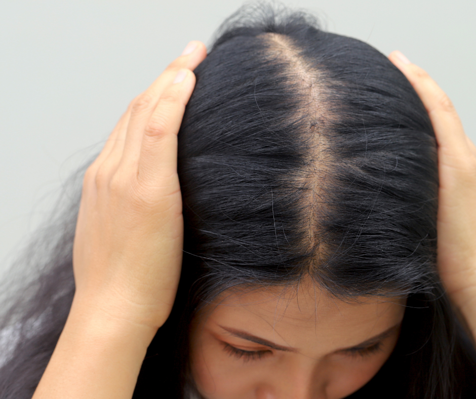 Best hair fall treatment in ghaziabad