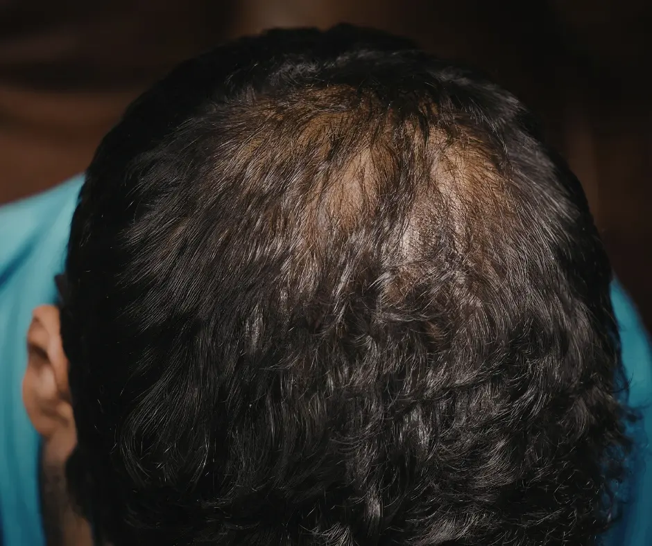 hair treatment clinic near me contact