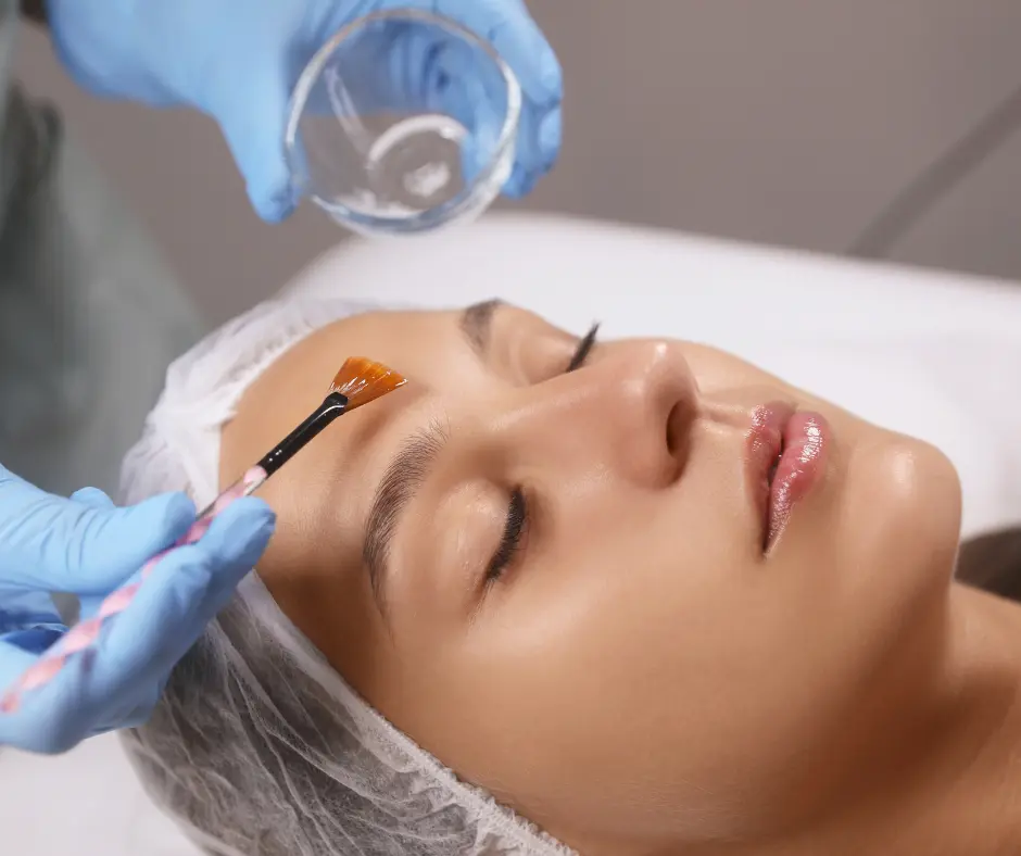 Chemical peel cost in Indirapuram