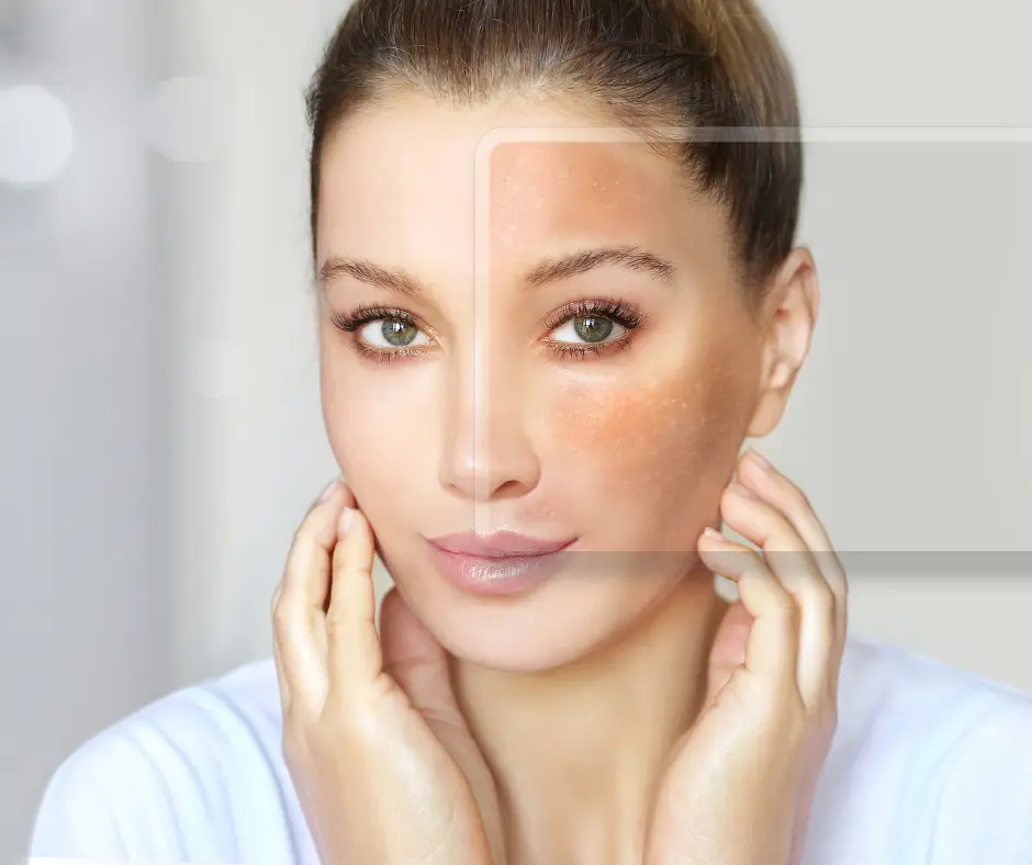 Skin Brightening Treatment in Raj Nagar Extension
