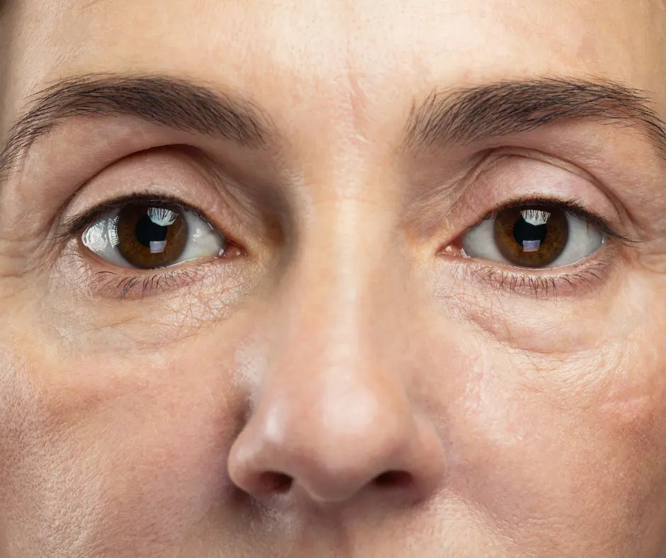 Dull Skin Treatment in Raj Nagar Extension